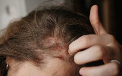 Covid 19 e capelli: come prevenire e trattare la caduta?